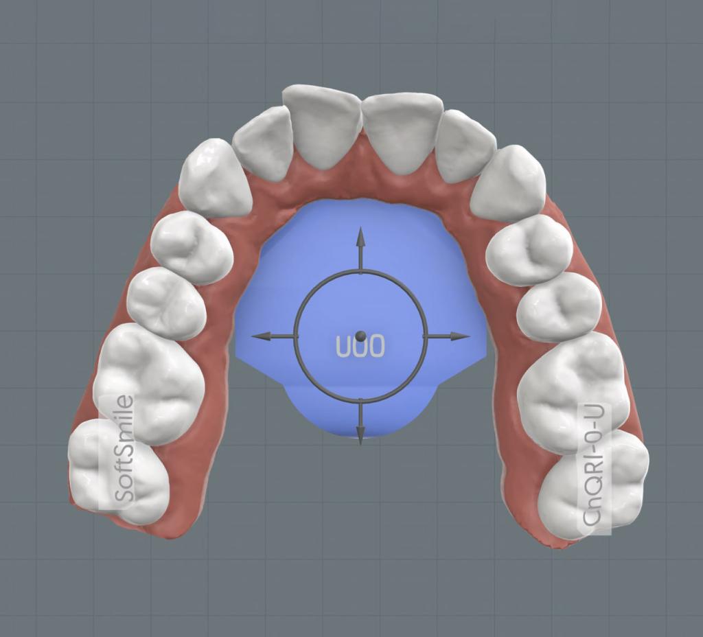 Aligner treatment planning software