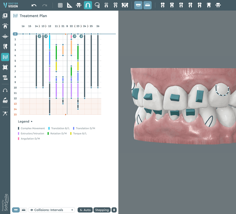 The third stage of work in Dr. Vision