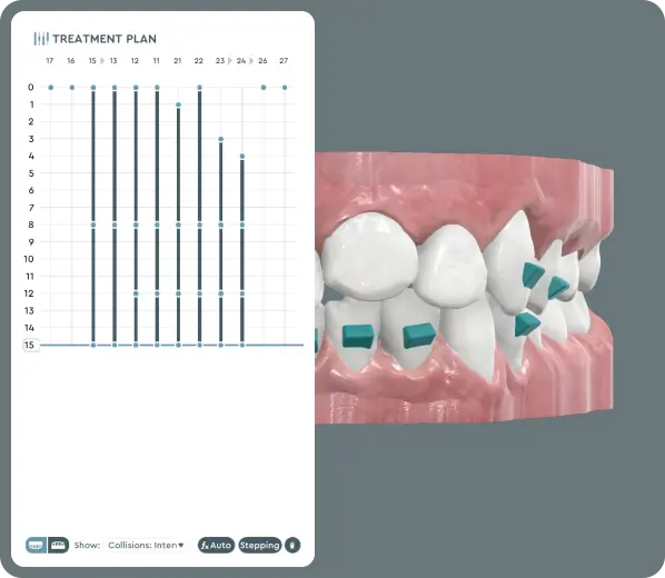Development of efficient treatment plans