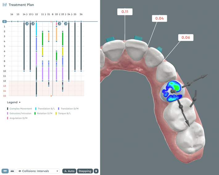 Treatment Plan Optimization Feature