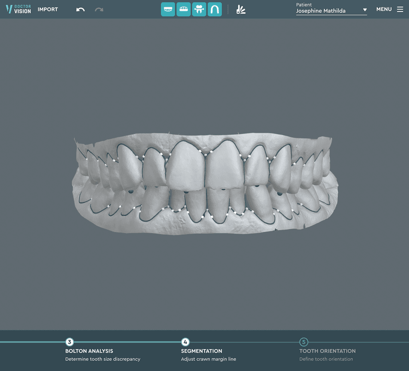 The first stage of work in Dr. Vision