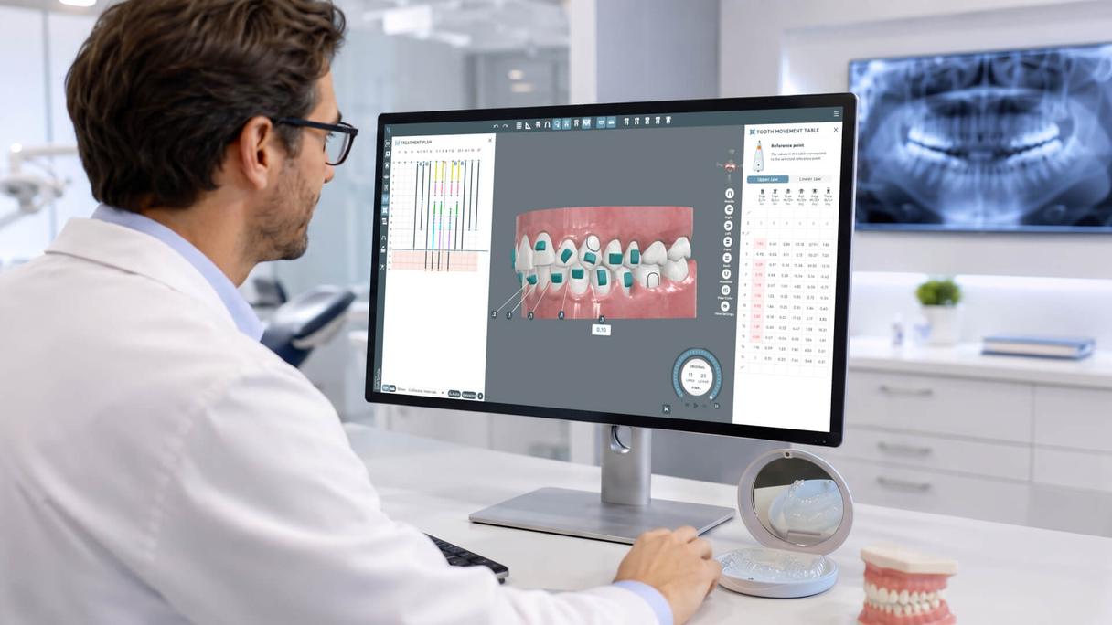 Clear aligner treatment planning workflow with digital 3D simulation and aligner trays