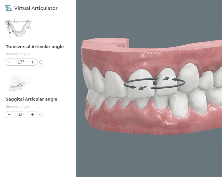 Virtual Articulator Feature