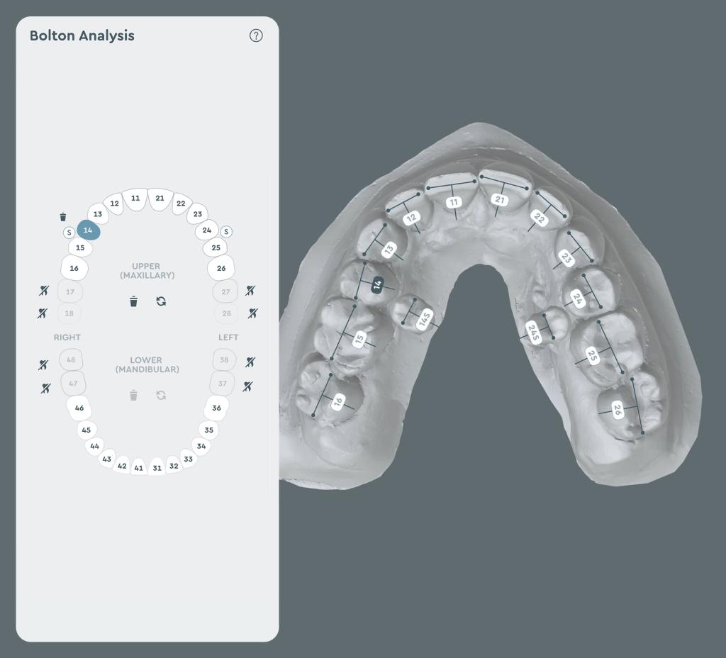 Aligner treatment planning software