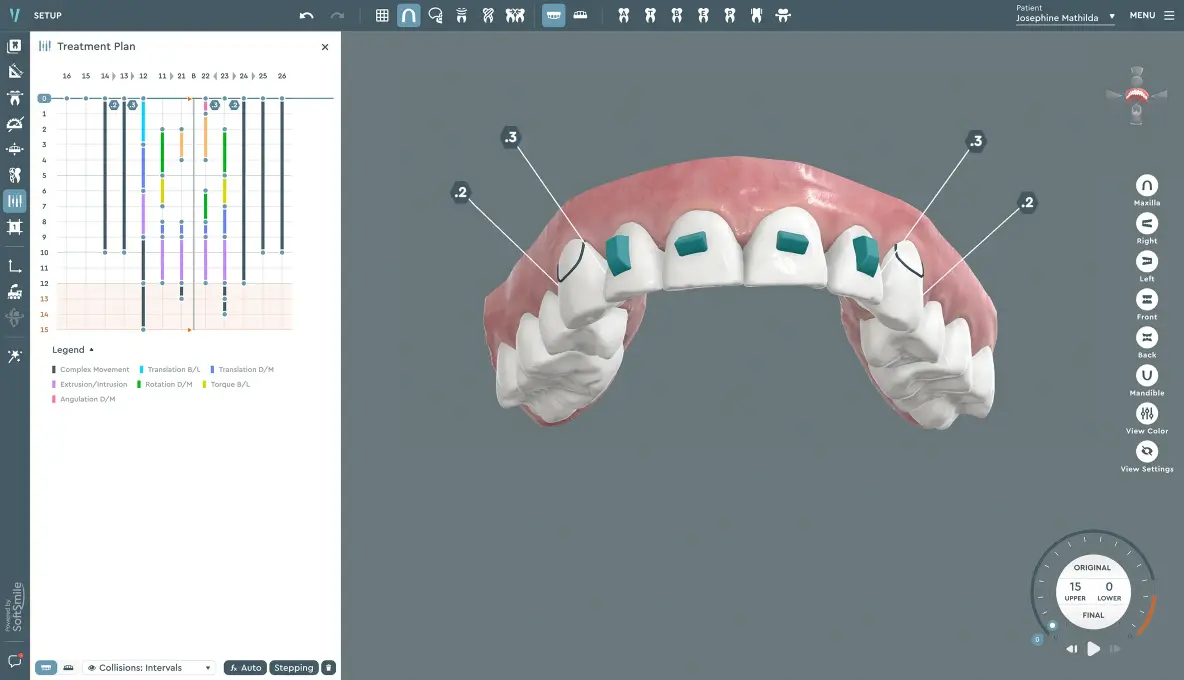 Vision LAB — Software for Orthodontic Labs