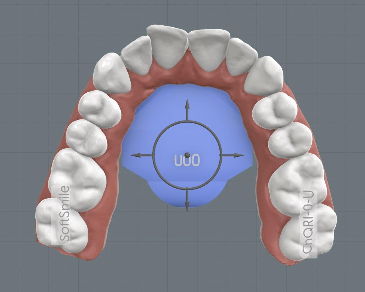 Dentist reviewing aligner plan and leaving comments on the treatment model