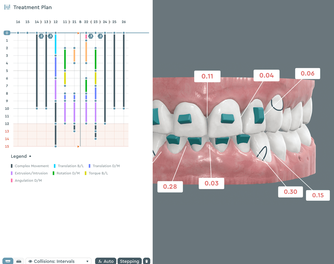 Visual staging panel displaying sequential tooth movements