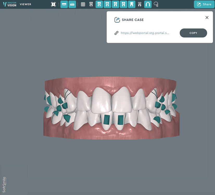 The fifth stage of work in Dr. Vision