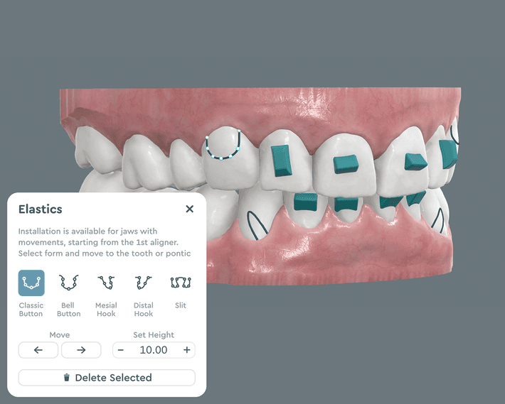 Elastics & Attachments Feature