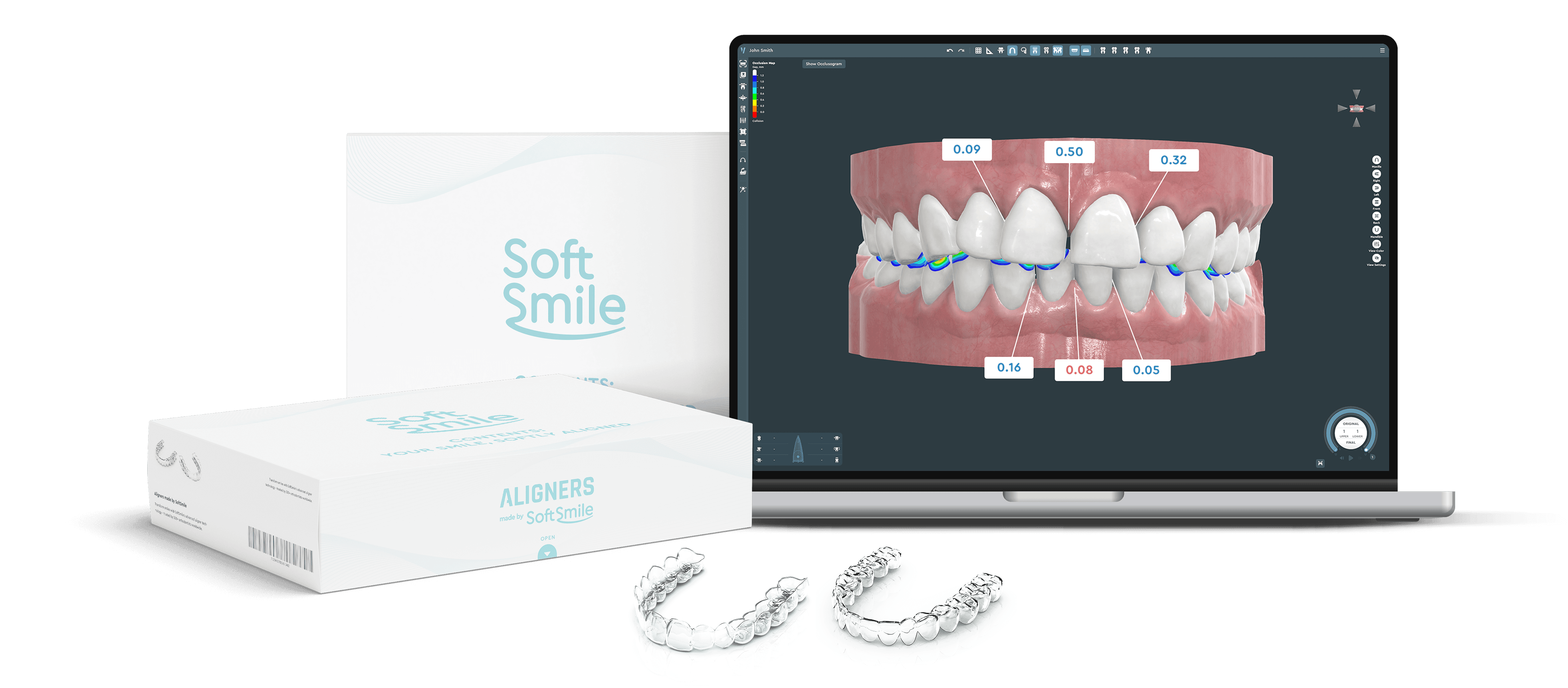 Aligner treatment planning software