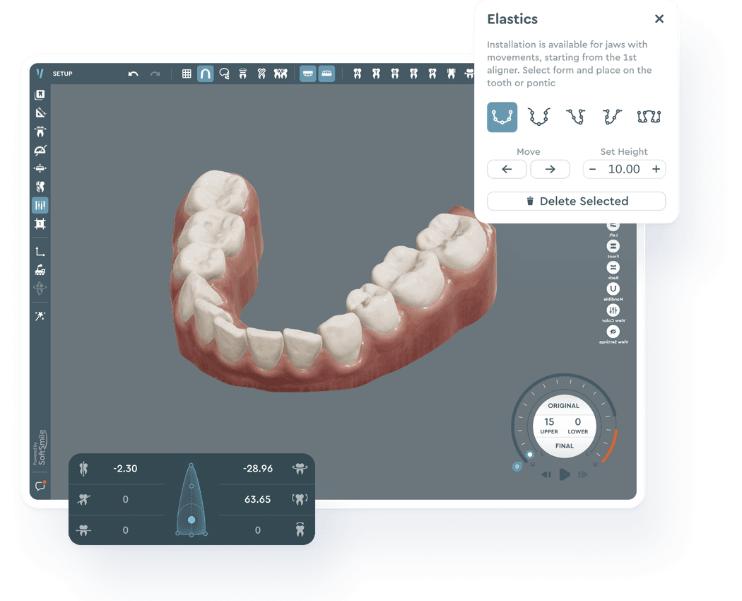 SoftSmile's aligner design solution rich in dental software features